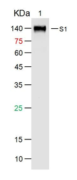 SARS S-protein Rabbit Polyclonal Antibody