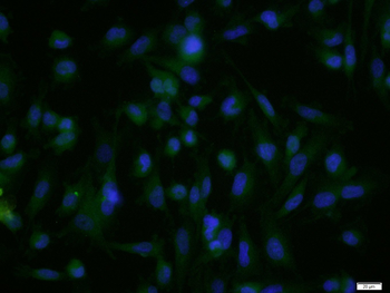 Semaphorin 3F Rabbit Polyclonal Antibody