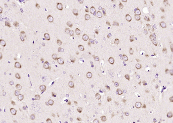 Semaphorin 3F Rabbit Polyclonal Antibody