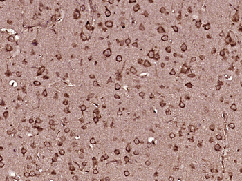 Semaphorin 3F Rabbit Polyclonal Antibody