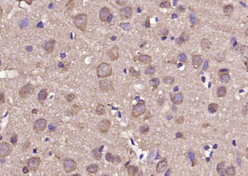 Sema4C Rabbit Polyclonal Antibody