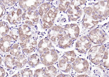 SFRP1 Rabbit Polyclonal Antibody