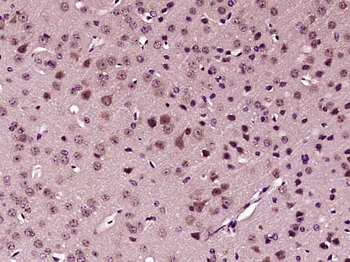 SFRP1 Rabbit Polyclonal Antibody