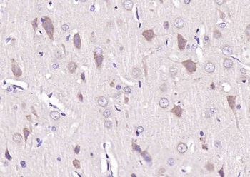 SFRP1 Rabbit Polyclonal Antibody