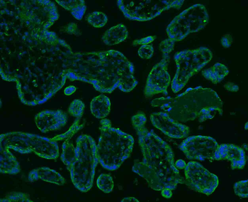 SGCB Rabbit Polyclonal Antibody