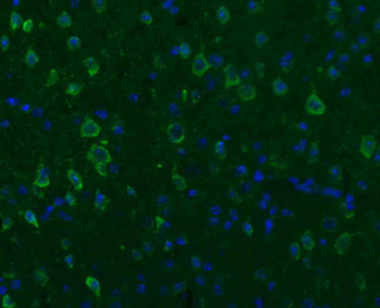 SGCB Rabbit Polyclonal Antibody