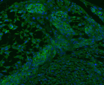 SGCB Rabbit Polyclonal Antibody