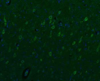 SGCB Rabbit Polyclonal Antibody