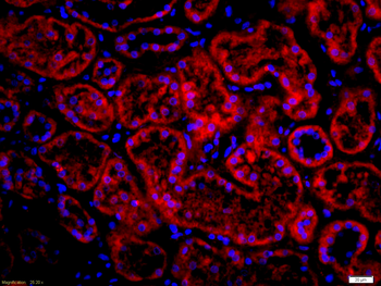 SLC6A19 Rabbit Polyclonal Antibody