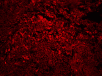 SNAI1 Rabbit Polyclonal Antibody