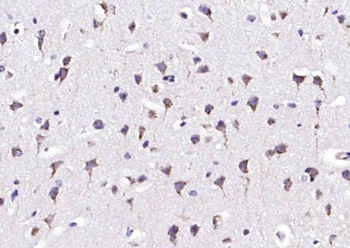 TPA Rabbit Polyclonal Antibody
