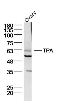 TPA Rabbit Polyclonal Antibody