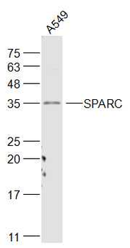 SPARC Rabbit Polyclonal Antibody