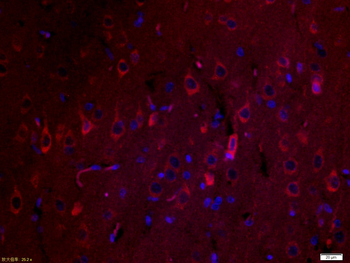 SPARC Rabbit Polyclonal Antibody