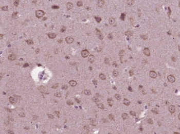SPARC Rabbit Polyclonal Antibody