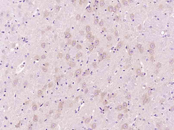 SPARC Rabbit Polyclonal Antibody