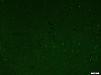 SRC Rabbit Polyclonal Antibody