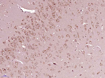 SRC Rabbit Polyclonal Antibody
