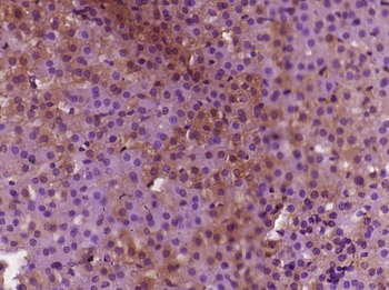 SREBP1 Rabbit Polyclonal Antibody