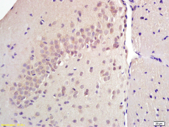SREBP1 Rabbit Polyclonal Antibody