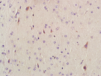 AKAP12 Rabbit Polyclonal Antibody
