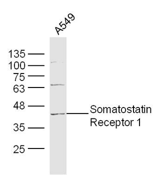 Somatostatin Receptor 1 Rabbit Polyclonal Antibody