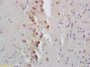 STAT1 Rabbit Polyclonal Antibody