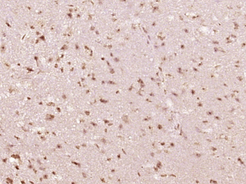 Phospho-STAT6 (Tyr641) Rabbit Polyclonal Antibody