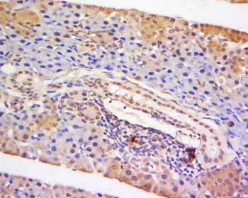 STAT5 Rabbit Polyclonal Antibody