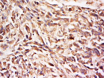 SYK Rabbit Polyclonal Antibody