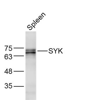 SYK Rabbit Polyclonal Antibody