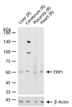 TPP1 Rabbit Polyclonal Antibody