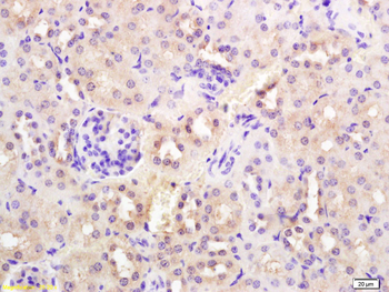 SYVN1 Rabbit Polyclonal Antibody