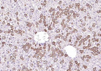 SYVN1 Rabbit Polyclonal Antibody