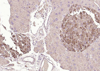 SYVN1 Rabbit Polyclonal Antibody