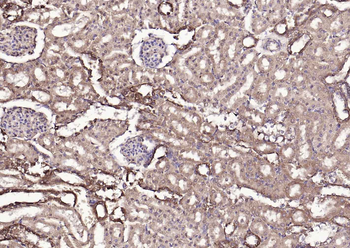 SYVN1 Rabbit Polyclonal Antibody