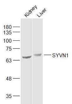 SYVN1 Rabbit Polyclonal Antibody