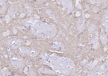 Alpha-Synuclein Rabbit Polyclonal Antibody