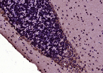 Phospho-Tau (Thr498) Rabbit Polyclonal Antibody