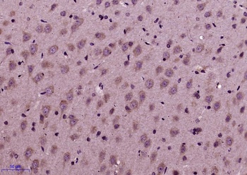 TAU (phospho-Thr489) antibody