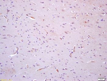 TIE1 Rabbit Polyclonal Antibody