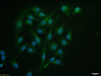Thymosin Alpha-1 Rabbit Polyclonal Antibody