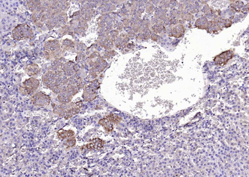 TIG2 Rabbit Polyclonal Antibody