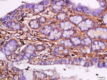TIG2 Rabbit Polyclonal Antibody