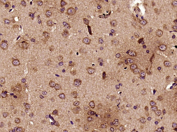 TOP1MT Rabbit Polyclonal Antibody