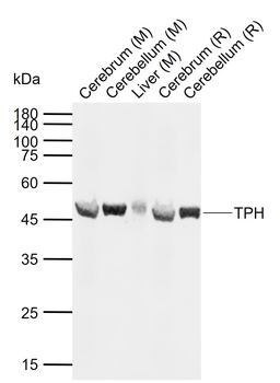 TPH Rabbit Polyclonal Antibody
