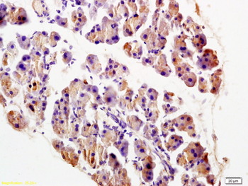 TRADD Rabbit Polyclonal Antibody