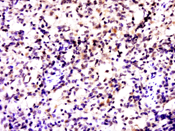 TRAF1 Rabbit Polyclonal Antibody