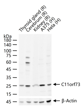 C11orf73 Rabbit Polyclonal Antibody