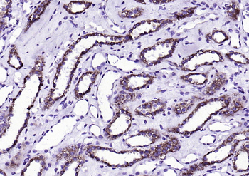 Fumarase/FH Mouse Monoclonal Antibody